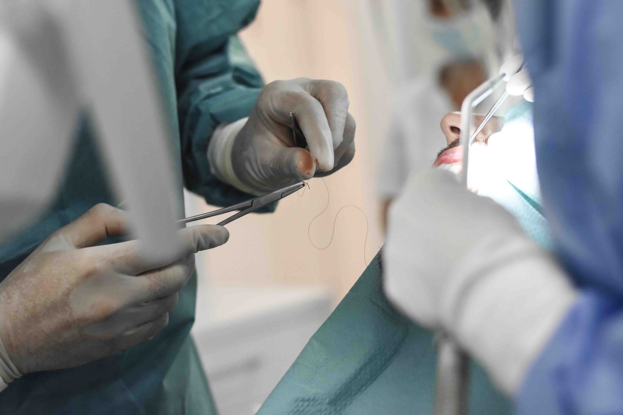 sinus-lift